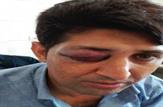 کتک کاری عضو شورای اسلامی دهستان راک توسط کارمند آب و فاضلاب روستایی+عکس
