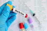 نخستین مورد از انتقال سویه H3N8 آنفلوانزای مرغی به انسان در چین شناسایی شد