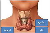 بیماری تیروئید در صورت عدم تشخیص به موقع عوارض جبران ناپذیر مغزی به دنبال دارد