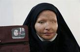 گفت‌وگو با دختري ۳۳ ساله از شهر دهدشت؛ من «سيما افشاري» قرباني اسيدپاشي هستم|مادرم از غصه من دق كرد و مُرد|برادرم سكته كرد و از دنيا رفت|به نان شبم هم محتاج شدم|به در و ديوار نگاه مي‌كنم تا عمرم تمام شود