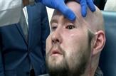 نخستین پیوند کامل چشم در جهان انجام شد